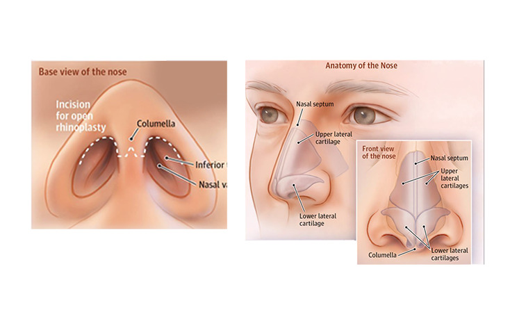 عمليات تجميل الأنف والأذن